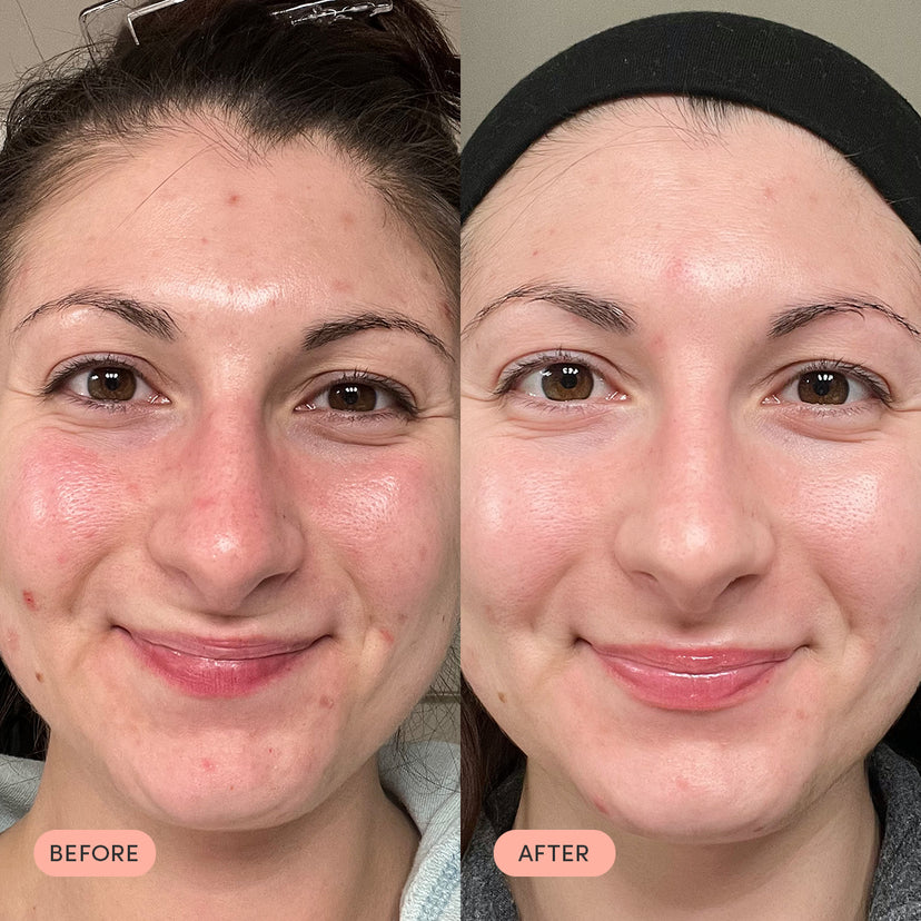 The Essentials results