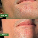 Oil Control Dual Action Blemish Patches Thumb 4