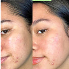 Oil Control Clearing Face Mask Thumb 1