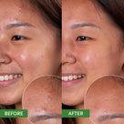 Oil Control Clearing Cleanser Thumb 1