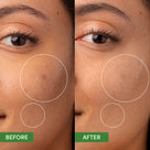 Oil Control Clearing Moisturizer Thumb 1