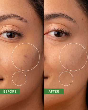 Oil Control Clearing Moisturizer