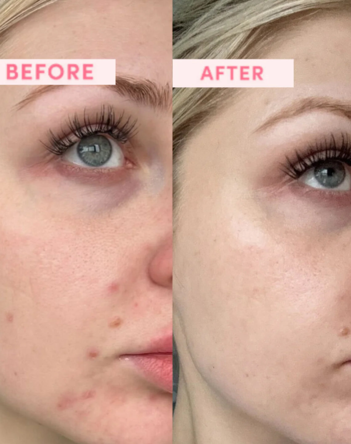 Australian Pink Clay Resurfacing Mask texture and consistency closeup