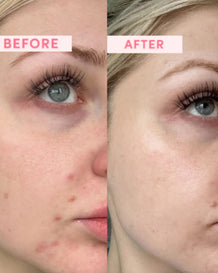 Australian Pink Clay Resurfacing Mask