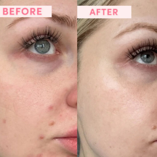 Australian Pink Clay Resurfacing Mask texture and consistency closeup