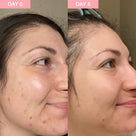 Pro Youth Dark Spot Serum Thumb 1