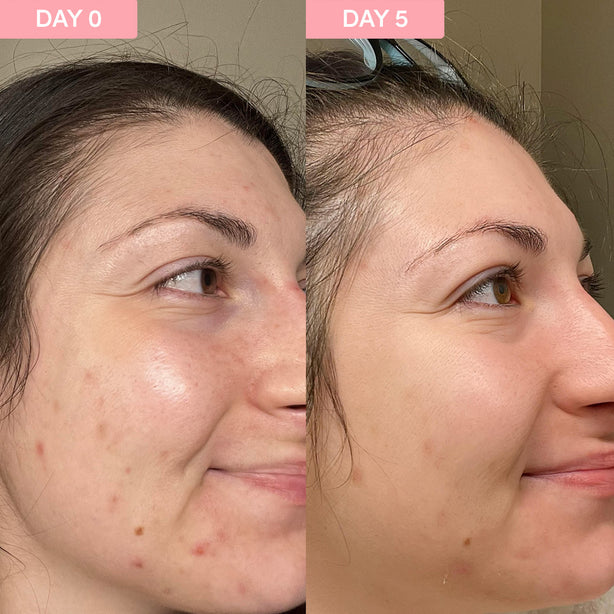 Pro Youth Dark Spot Serum texture and consistency closeup